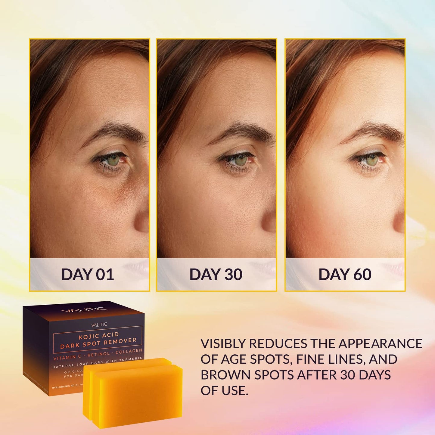 Kojic Acid Dark Spot Remover Soap Bars with Vitamin C, Retinol, Collagen, and Turmeric - Original Japanese Formula Enriched with Hyaluronic Acid, Vitamin E, Shea Butter, and Castile Olive Oil (2 Pack)